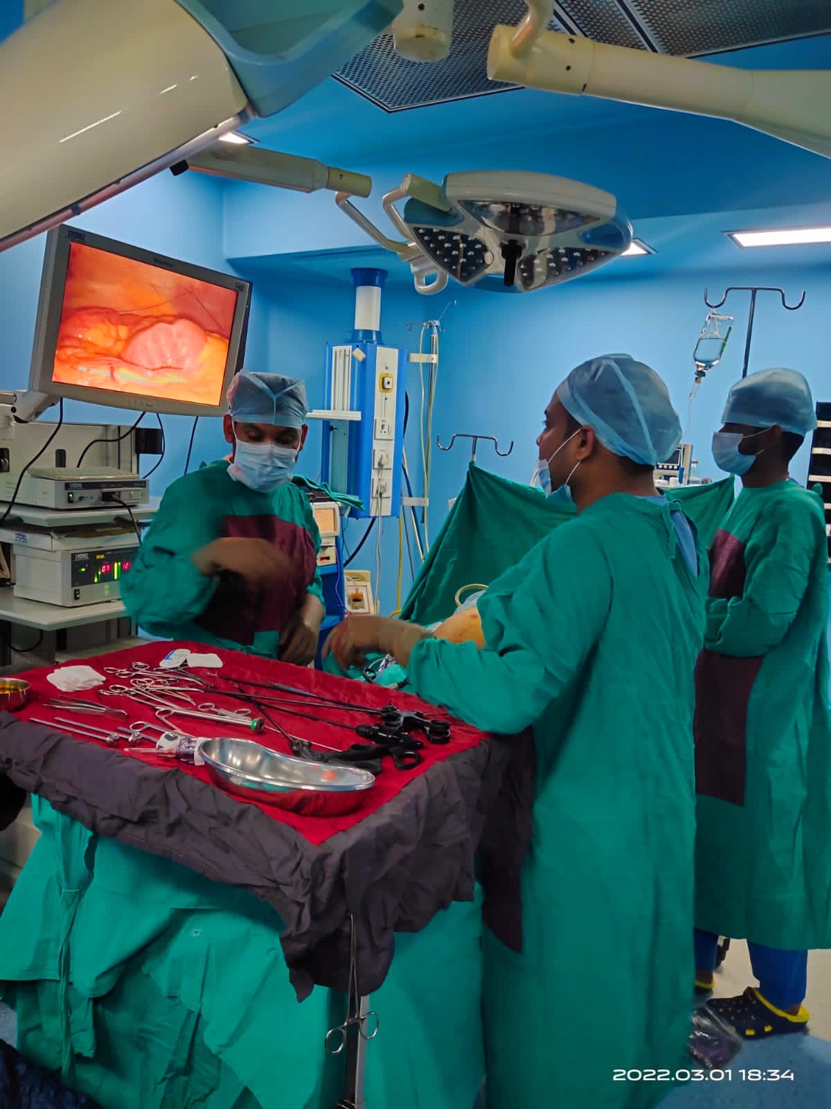 Laparoscopic Umbilical Hernia Surgery